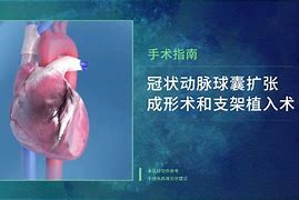 xcc提取器